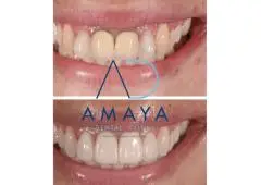 Best Dental Clinic in Bangalore | Top Dentist Bangalore