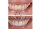Best Dental Clinic in Bangalore | Top Dentist Bangalore